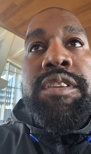 Concern for Kanye West as he displays worrying growth on lip after undergoing experimental surgery