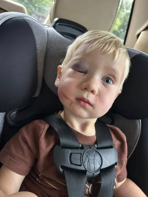 Day Care worker accused of b3ating 1-year-old ?black and blue?�released on bail