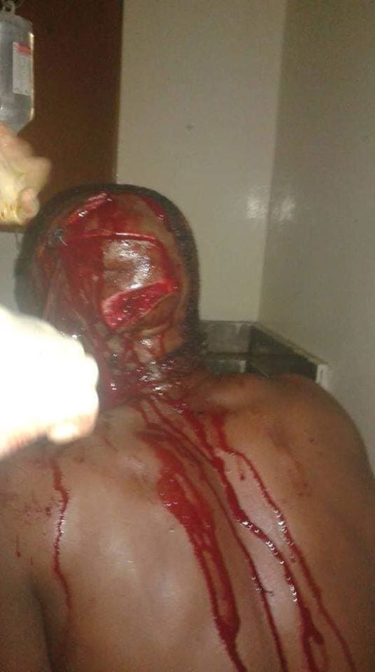 Graphic: See what criminals did to a young man just to steal his motorcycle