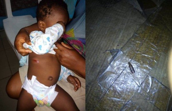 Baby nearly killed by stray bullet allegedly fired by police officer in Port Harcourt (photos)