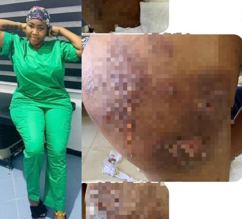 Dr Aanu trends as a new victim emerges and accuses her of destroying her body after she continued practicing in Abuja despite court case (graphic photos)