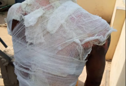 Housewife on the run after killing husband with hot water while he was asleep in Ogun 