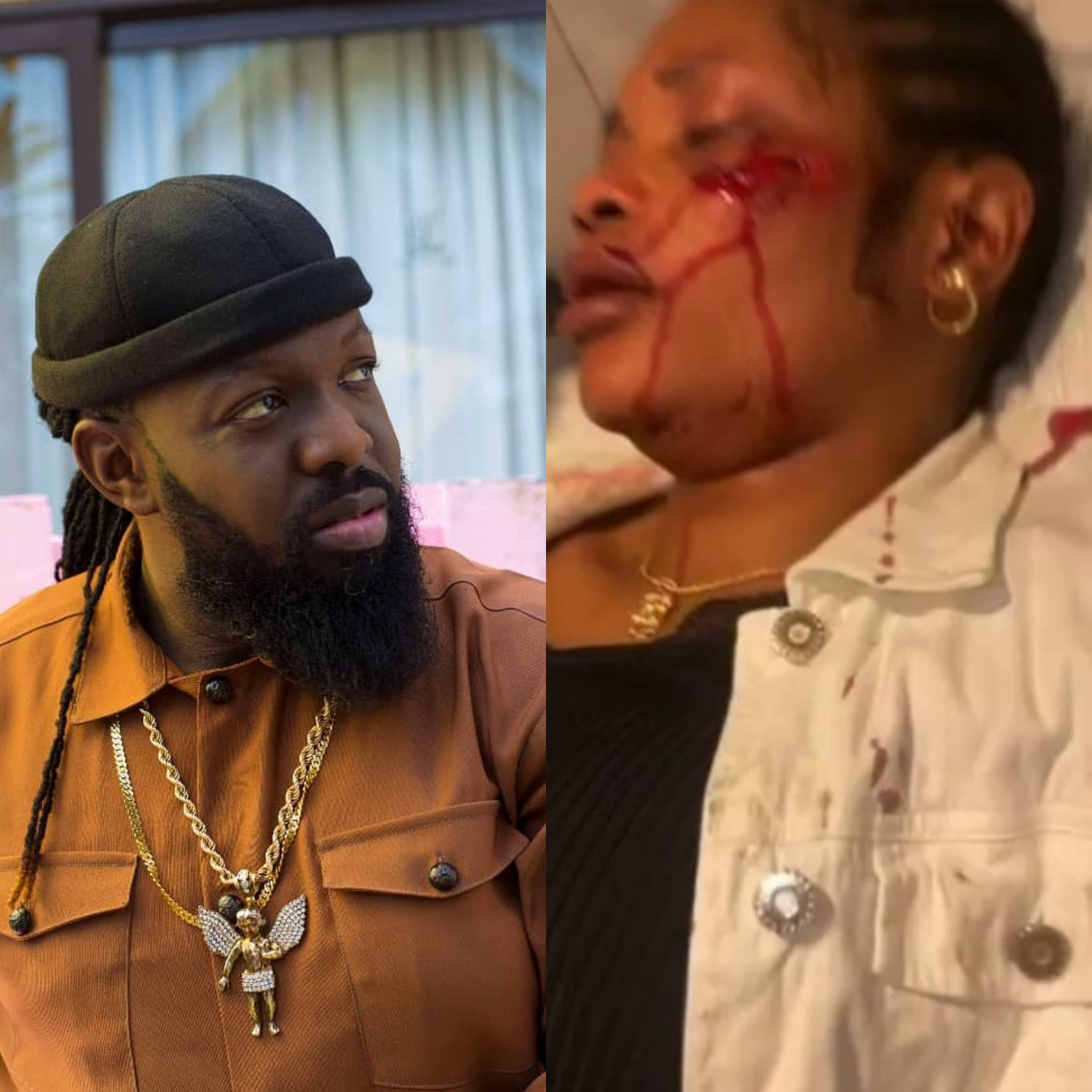 Hit and run accident: Timaya denies arrest by police, says he was only interrogated