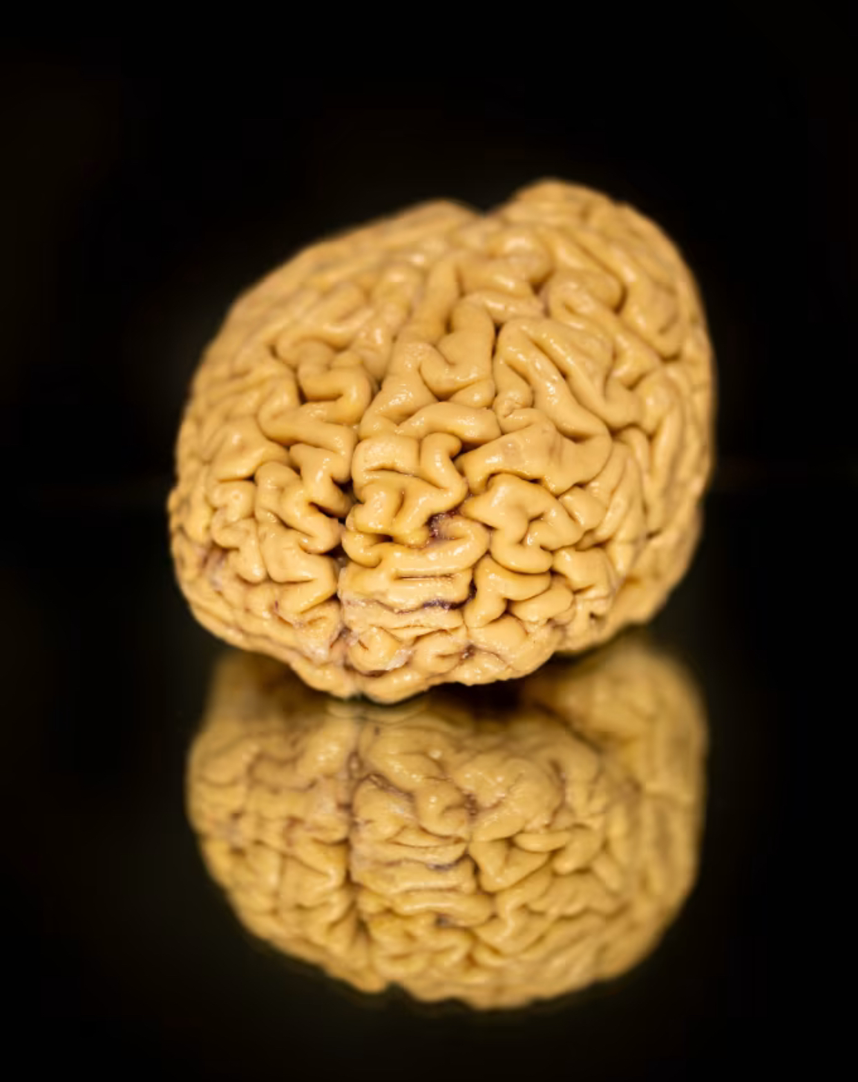 Scientists discover a key to staying mentally sharp in old age