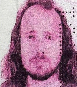 Man, 36, diÂ£s after flying from Britain to Turkey for hair transplant