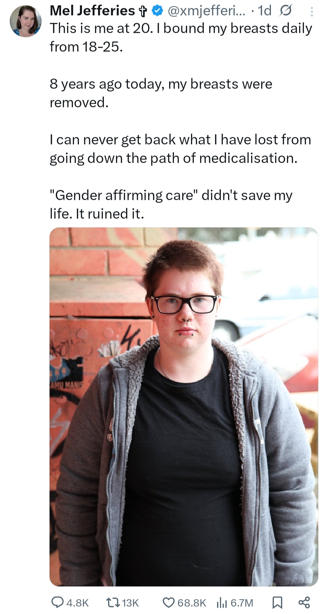 Woman who transitioned to a man says it 