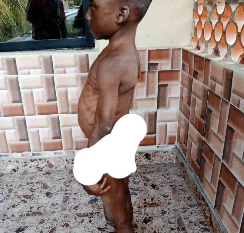 Horrific photos of a child brutalized and chained for weeks by his guardian in Abia