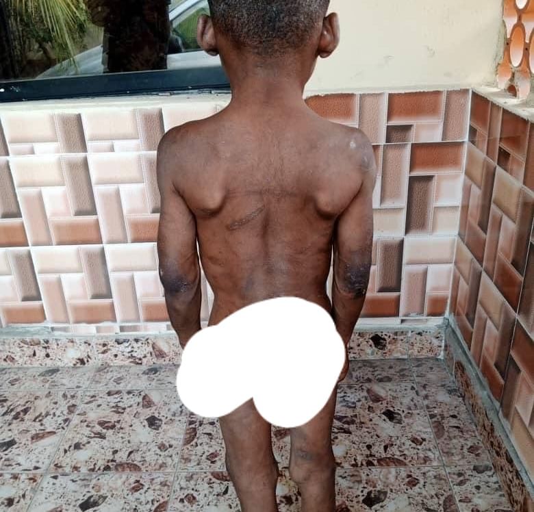 Horrific photos of a child brutalized and chained for weeks by his guardian in Abia