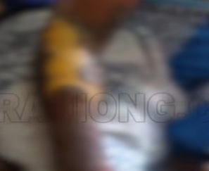 Man bathes girlfriend with acid in Edo