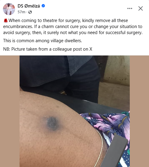 When coming to theatre for surgery, kindly remove your charms - Nigerian doctor says