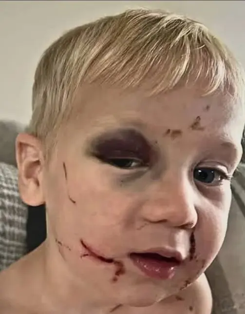 Day Care worker accused of b3ating 1-year-old ?black and blue?�released on bail