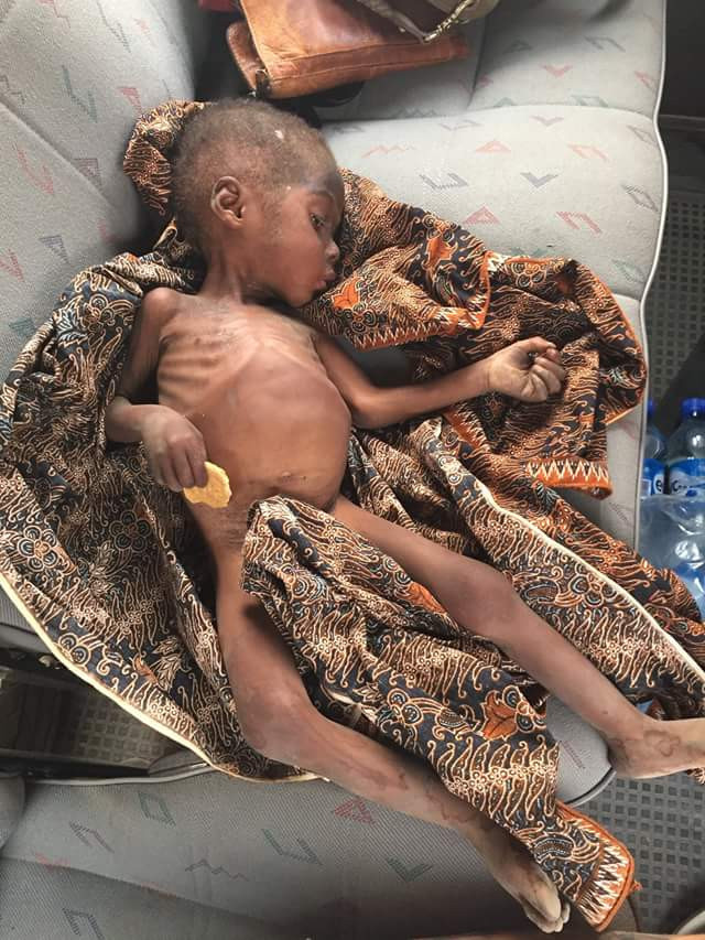 Akwa Ibom boy, Hope reunites with his mother seven years after he was branded a witch, stigmatized and left to starve to death