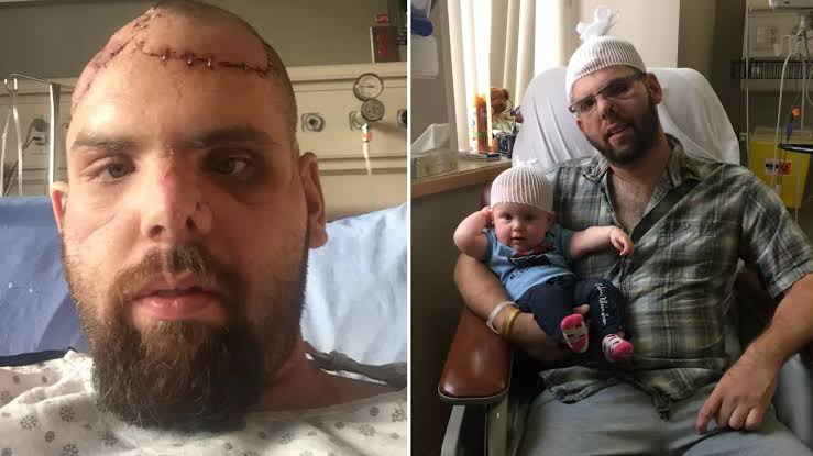 Man reveals how his face was ripped off by grizzly bear in brutal attack