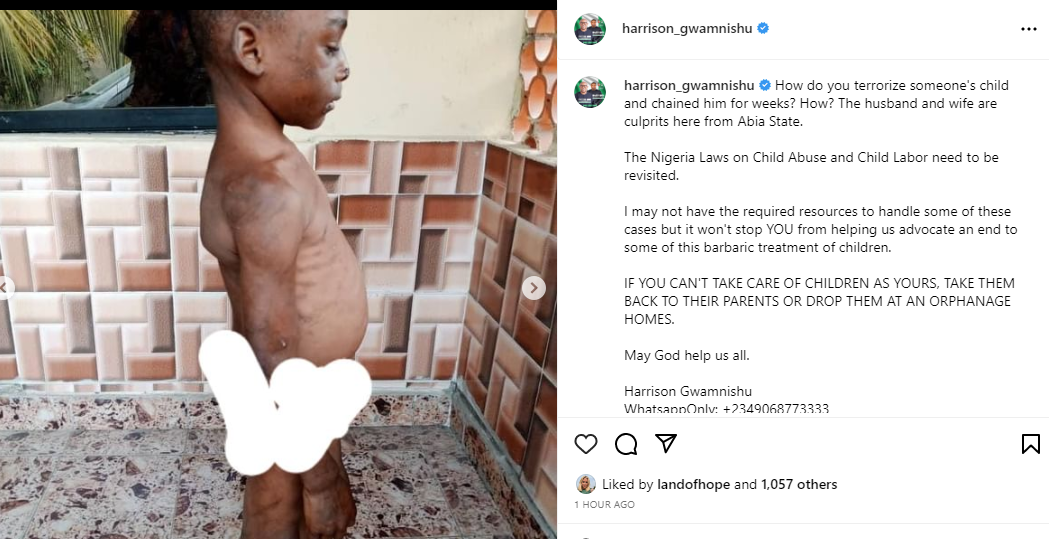 Horrific photos of a child brutalized and chained for weeks by his guardian in Abia