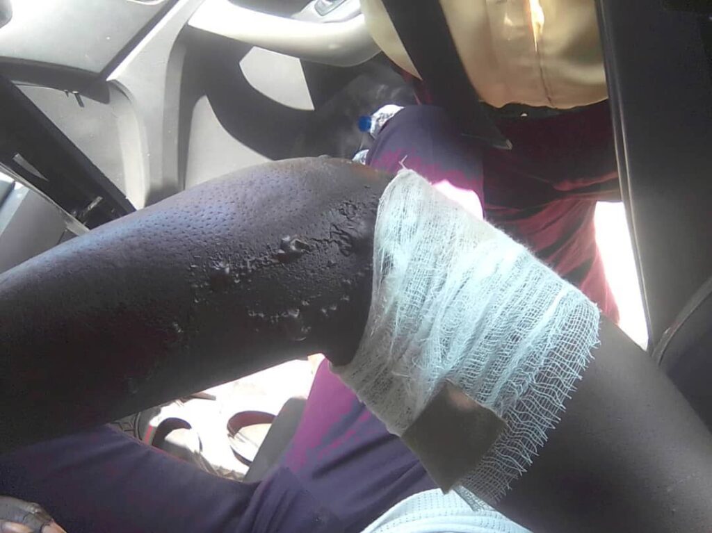 Lagos driver sets self, LASTMA officer, bus ablaze