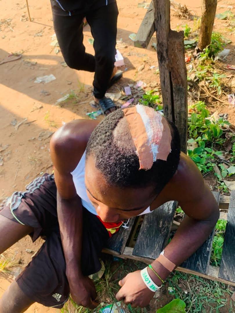 Falling tree k!lls one, injures seven in Benue community